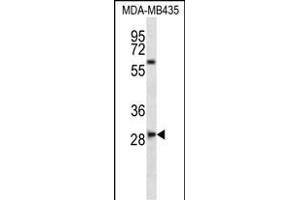 SLF8 Antibody (C-term) (ABIN656795 and ABIN2846014) western blot analysis in MDA-M cell line lysates (35 μg/lane). (SLAMF8 anticorps  (C-Term))