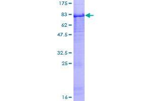 Image no. 1 for Peptidase Inhibitor 16 (PI16) (AA 1-408) protein (GST tag) (ABIN1314966)