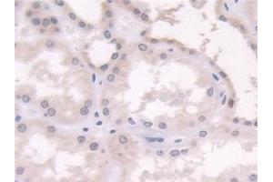 Detection of CRABP2 in Human Kidney Tissue using Polyclonal Antibody to Cellular Retinoic Acid Binding Protein 2 (CRABP2)