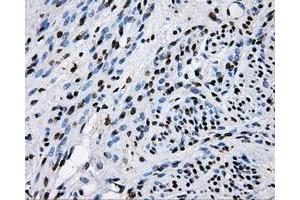 Immunohistochemical staining of paraffin-embedded endometrium tissue using anti-RALBP1mouse monoclonal antibody. (RALBP1 anticorps)