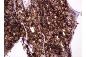 Image no. 5 for anti-Mucin 1 (MUC1) antibody (ABIN1499598)