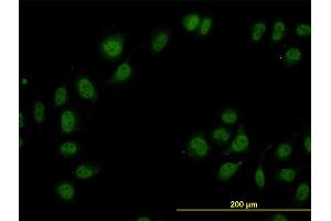 anti-Cullin-Associated and Neddylation-Dissociated 1 (CAND1) (AA 1-100) antibody