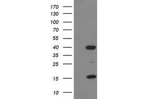 Western Blotting (WB) image for anti-PDZ and LIM Domain 2 (PDLIM2) antibody (ABIN1500126) (PDLIM2 anticorps)