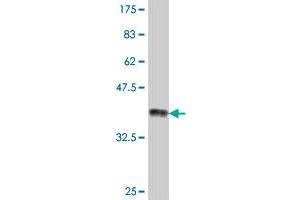 Western Blot detection against Immunogen (38. (ZNF83 anticorps  (AA 1-111))