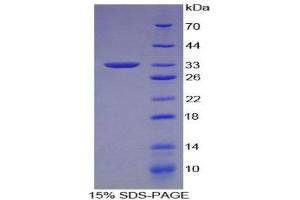 SDS-PAGE (SDS) image for Neural Cell Adhesion Molecule 1 (NCAM1) (AA 340-608) protein (His tag,T7 tag) (ABIN1879059)