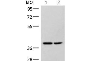 Western blot analysis of Hela and 231 cell lysates using HPDL Polyclonal Antibody at dilution of 1:400 (HPDL anticorps)