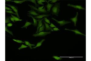 Immunofluorescence of purified MaxPab antibody to TRAF4 on HeLa cell. (TRAF4 anticorps  (AA 1-470))