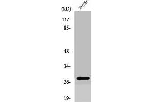 Western Blot analysis of COLO205 cells using Six3/6 Polyclonal Antibody (SIX Homeobox 6 anticorps  (Internal Region))