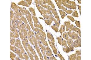 Immunohistochemistry of paraffin-embedded Mouse heart using GLUT4 Polyclonal Antibody at dilution of 1:100 (40x lens).
