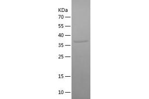 Western Blotting (WB) image for Odontogenic, Ameloblast Asssociated (ODAM) (AA 1-153) protein (His-IF2DI Tag) (ABIN7124252)