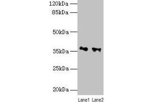 Western blot All lanes: RDH11 antibody at 10 μg/mL Lane 1: PC-3 whole cell lysate Lane 2: Hela whole cell lysate Secondary Goat polyclonal to rabbit IgG at 1/10000 dilution Predicted band size: 36, 35, 28 kDa Observed band size: 36 kDa (RDH11 anticorps  (AA 22-318))