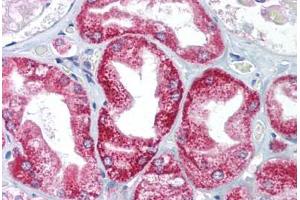 Human Kidney (formalin-fixed, paraffin-embedded) stained with AIFM1 antibody ABIN214083 at 5 ug/ml followed by biotinylated goat anti-rabbit IgG secondary antibody ABIN481713, alkaline phosphatase-streptavidin and chromogen.