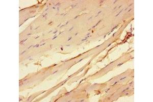 Immunohistochemistry of paraffin-embedded human skeletal muscle tissue using ABIN7142955 at dilution of 1:100 (CHRNA1 anticorps  (AA 21-255))