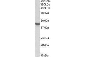 Western Blotting (WB) image for anti-Solute Carrier Family 2 (Facilitated Glucose Transporter), Member 4 (SLC2A4) (AA 498-509) antibody (ABIN1492810) (GLUT4 anticorps  (AA 498-509))