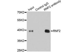 Immunoprecipitation analysis of 200ug extracts of 293T cells using 1ug RNF2 antibody.