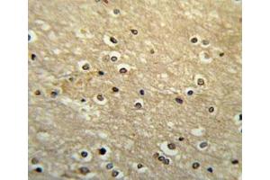 PAX-6 antibody immunohistochemistry analysis in formalin fixed and paraffin embedded human brain tissue