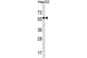 ALDH3B2 Antibody (C-term) western blot analysis in HepG2 cell line lysates (35 µg/lane). (ALDH3B2 anticorps  (C-Term))