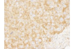 Immunohistochemistry (IHC) image for anti-Eukaryotic Translation Initiation Factor 3 Subunit A (EIF3A) (AA 860-910) antibody (ABIN7448546) (EIF3A anticorps  (AA 860-910))