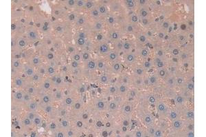 Detection of CA2 in Rat Liver Tissue using Polyclonal Antibody to Carbonic Anhydrase II (CA2)