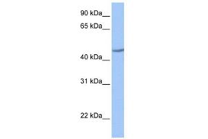 WB Suggested Anti-ZNF485 Antibody Titration:  0. (ZNF485 anticorps  (C-Term))