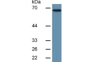 Rabbit Capture antibody from the kit in WB with Positive Control: Sample Rat Liver Tissue.