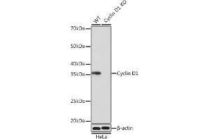 anti-Cyclin D1 (CCND1) antibody