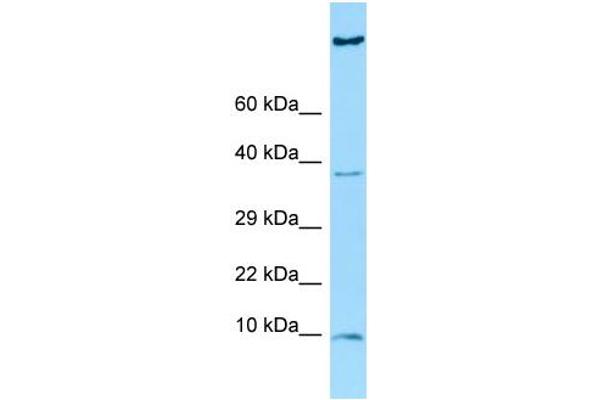 HGSNAT anticorps  (C-Term)