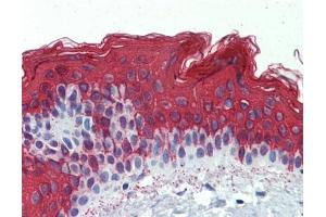 Cytokeratin 1 antibody was used for immunohistochemistry at a concentration of 4-8 ug/ml. (Cytokeratin 1 anticorps)