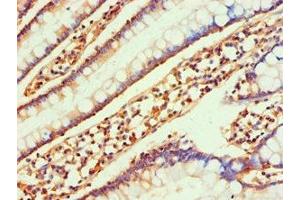 Immunohistochemistry of paraffin-embedded human small intestine tissue using ABIN7145991 at dilution of 1:100 (CCL25 anticorps  (AA 24-150))
