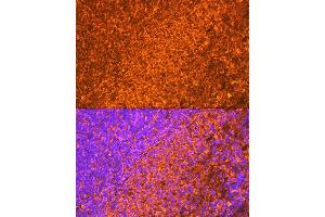Immunofluorescence analysis of rat spleen cells using EBI3 Rabbit mAb (ABIN7268011) at dilution of 1:100 (40x lens). (EBI3 anticorps)