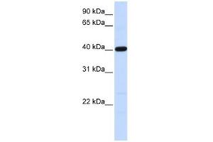 Tropomodulin 3 antibody used at 1 ug/ml to detect target protein. (TMOD3 anticorps)
