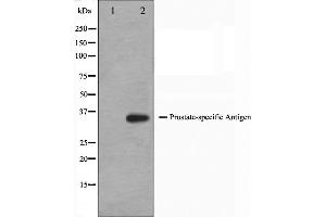 Western blot analysis on mouse heart cell lysate using KLK3 Antibody,The lane on the left is treated with the antigen-specific peptide. (Prostate Specific Antigen anticorps  (Internal Region))
