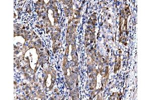 IHC analysis of DLX2 using anti-DLX2 antibody (ABIN7599936). (DLX2 anticorps  (AA 13-310))