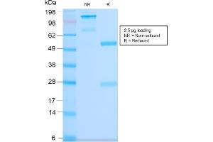 SDS-PAGE Analysis Purified CD63 Rabbit Recombinant Monoclonal Antibody (LAMP3/2990R). (Recombinant CD63 anticorps)