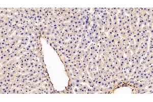 Detection of CAV1 in Rat Liver Tissue using Polyclonal Antibody to Caveolin 1 (CAV1)