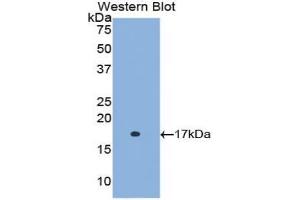 Western blot analysis of the recombinant protein. (Retinol Binding Protein 5 anticorps  (AA 1-135))