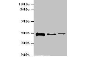 Western blot All lanes: STK16 antibody at 12 μg/mL Lane 1: A549 whole cell lysate Lane 2: Mouse brain tissue Lane 3: A431 whole cell lysate Secondary Goat polyclonal to rabbit IgG at 1/10000 dilution Predicted band size: 35 kDa Observed band size: 35 kDa (STK16 anticorps  (AA 1-305))