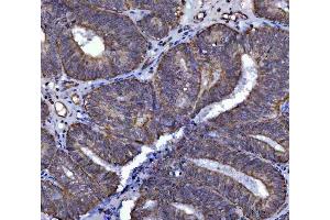 IHC analysis of SARS2 using anti-SARS2 antibody (ABIN7601804). (SARS2 anticorps  (AA 46-518))