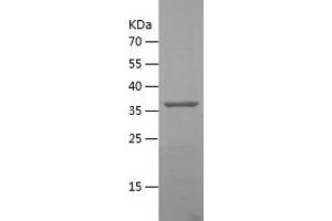 Western Blotting (WB) image for Dipeptidyl-Peptidase 9 (DPP9) (AA 291-438) protein (His-IF2DI Tag) (ABIN7122674) (DPP9 Protein (AA 291-438) (His-IF2DI Tag))