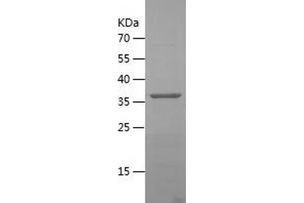 DPP9 Protein (AA 291-438) (His-IF2DI Tag)