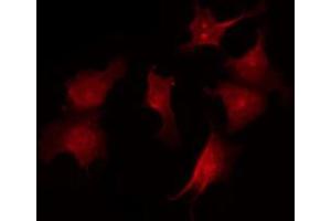 ABIN6267535 staining A2780 by IF/ICC.