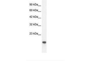 Image no. 2 for anti-C-Myc Binding Protein (MYCBP) (C-Term) antibody (ABIN202015) (MYCBP anticorps  (C-Term))