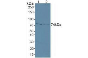 Western blot analysis of (1) Human MCF7 Cells and (2) Human A431 Cells. (MMP2 anticorps  (AA 110-660))