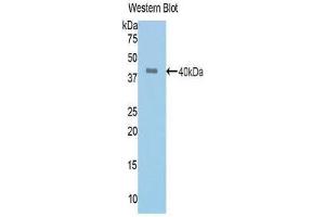 Western Blotting (WB) image for anti-Angiotensin I Converting Enzyme (Peptidyl-Dipeptidase A) 1 (ACE) (AA 504-597) antibody (ABIN1171910) (Angiotensin I Converting Enzyme 1 anticorps  (AA 504-597))
