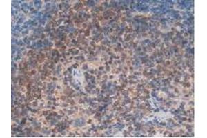 IHC-P analysis of Rat Spleen Tissue, with DAB staining. (ITGAD anticorps  (AA 879-1099))