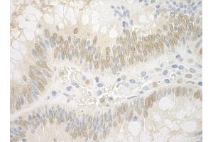 Immunohistochemistry (IHC) image for anti-Aryl Hydrocarbon Receptor Nuclear Translocator (ARNT) (AA 575-625) antibody (ABIN7453514)