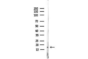 anti-Nucleoredoxin-Like 2 (NXNL2) antibody