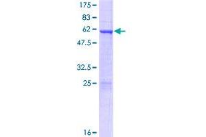 Image no. 1 for Homeobox D4 (HOXD4) (AA 1-255) protein (GST tag) (ABIN1307010)