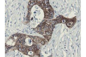 Image no. 5 for anti-Src-like-adaptor 2 (SLA2) antibody (ABIN1500946) (SLAP2 anticorps)