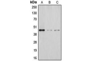 Western blot analysis of DHPS expression in Jurkat (A), JAR (B), HeLa (C) whole cell lysates.